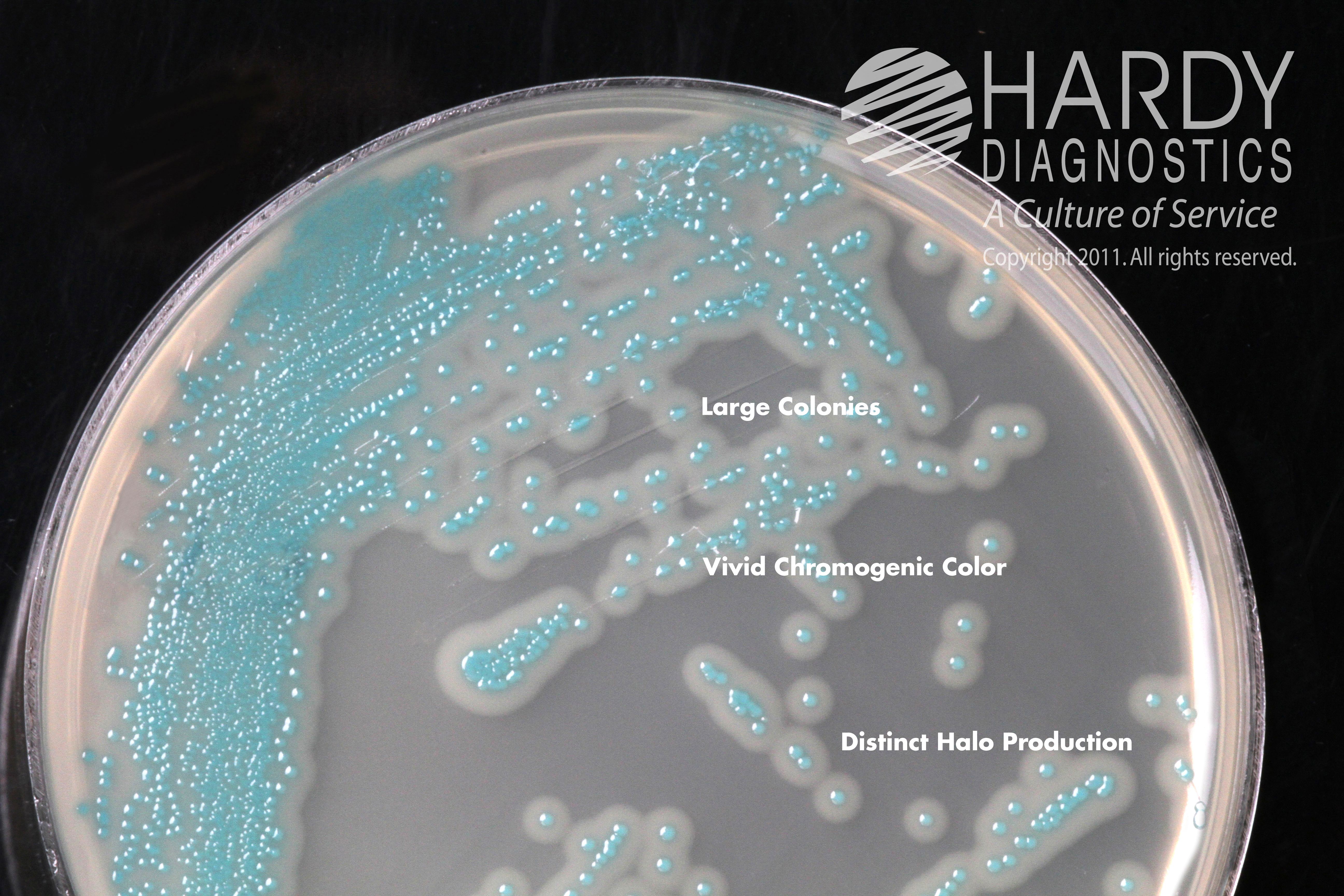 Listeria monocytogenes colonies