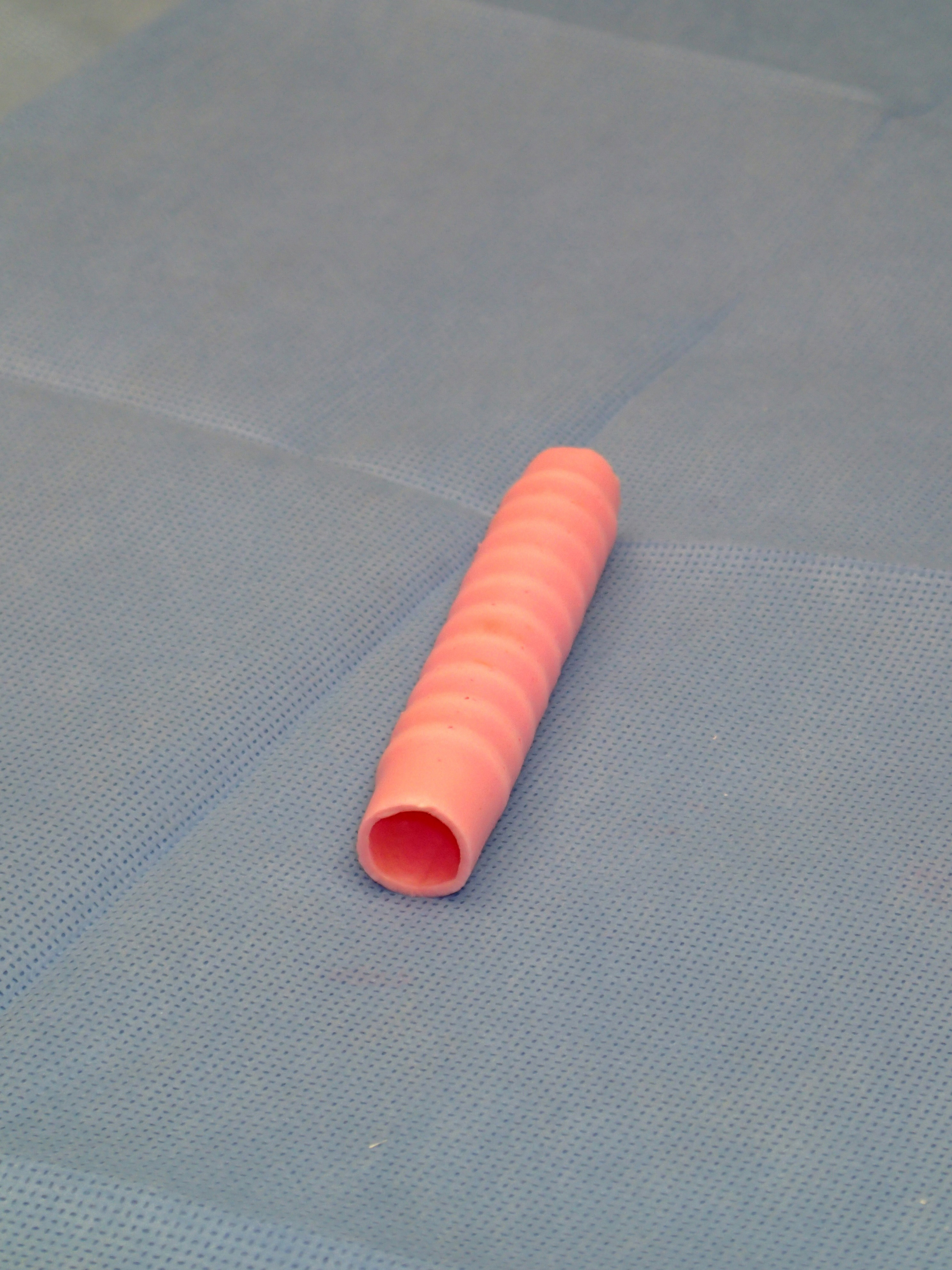 Tracheal Scaffold