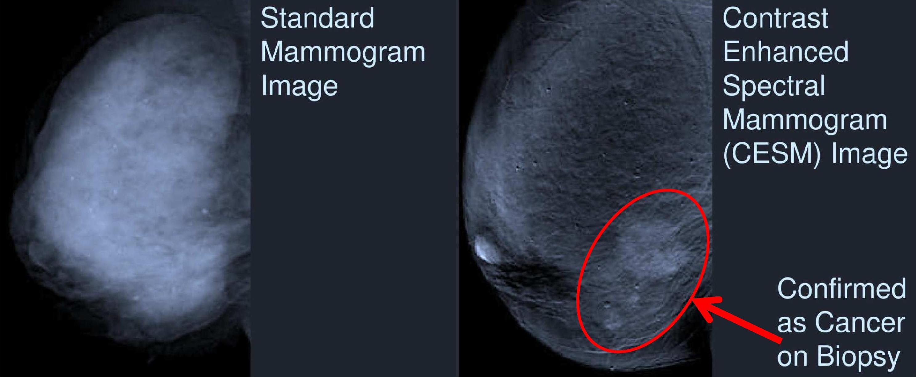 CESM Image 
