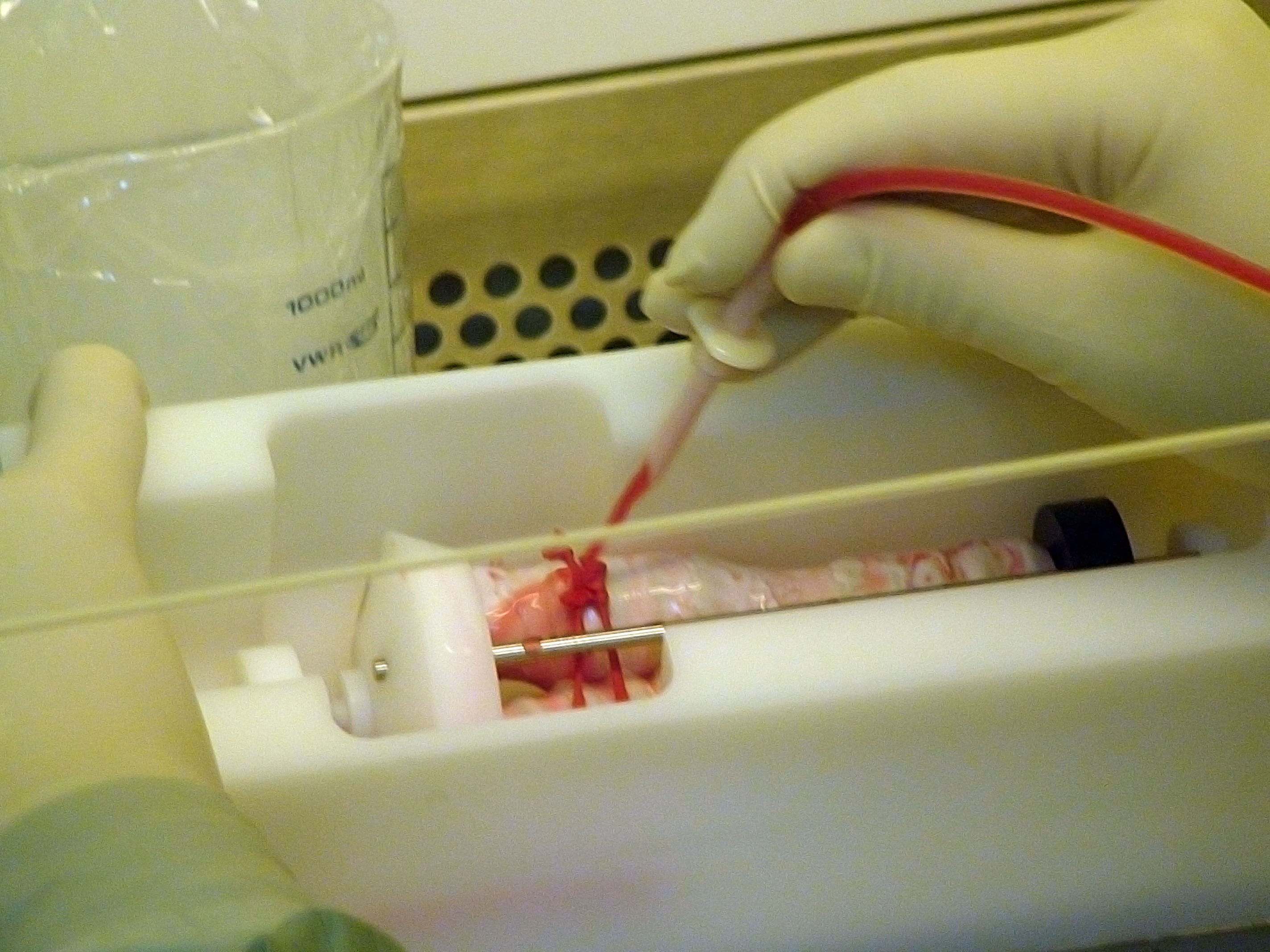 InBreath Bioreactor