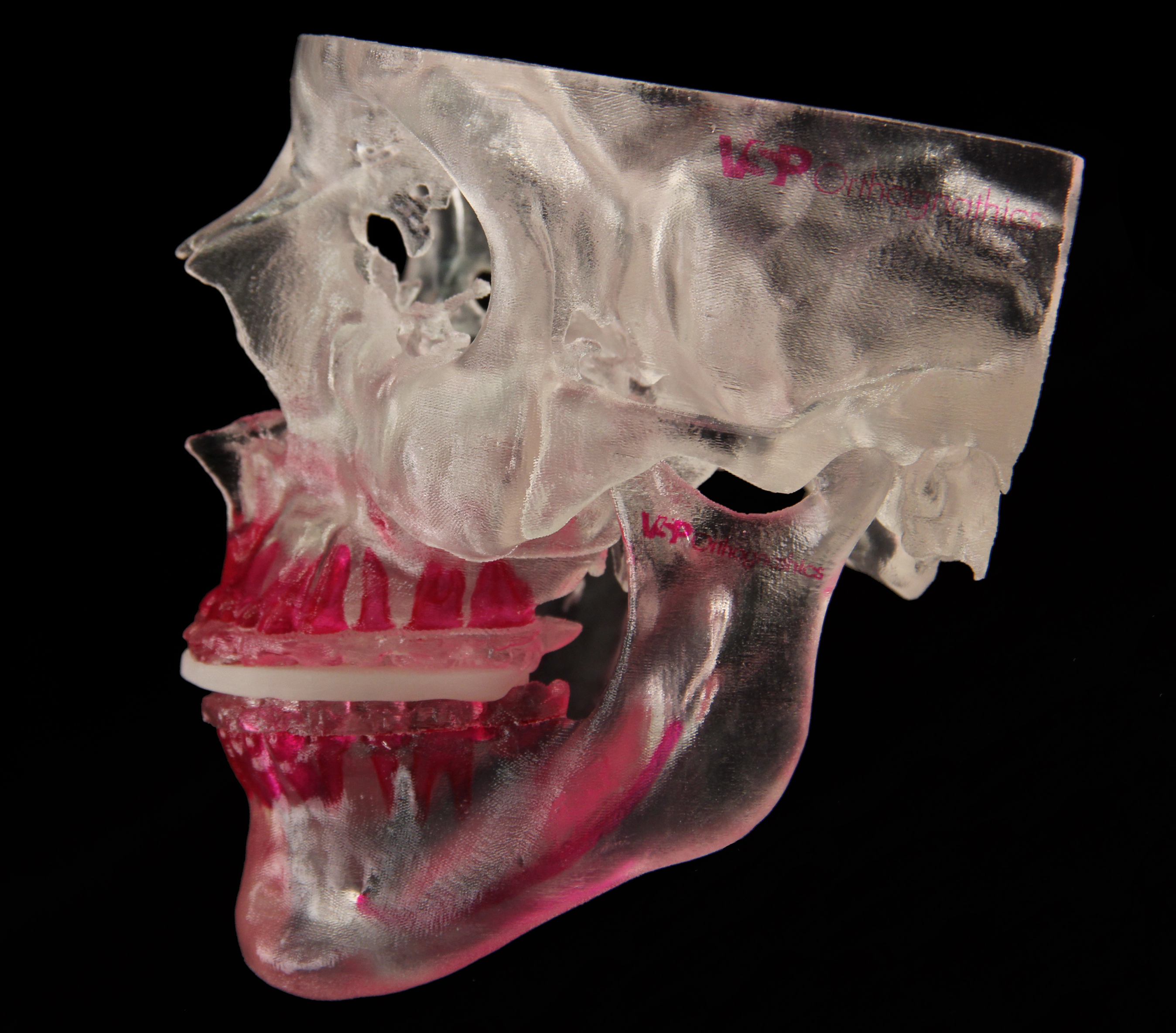 3D Systems VSP(R) Orthognathics