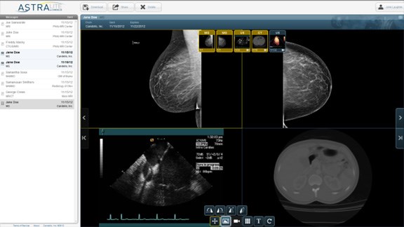Mammography and Ultrasound Images