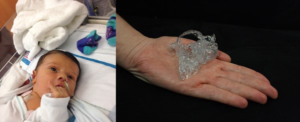 A recent example of Materialise's 3D printed HeartPrint services