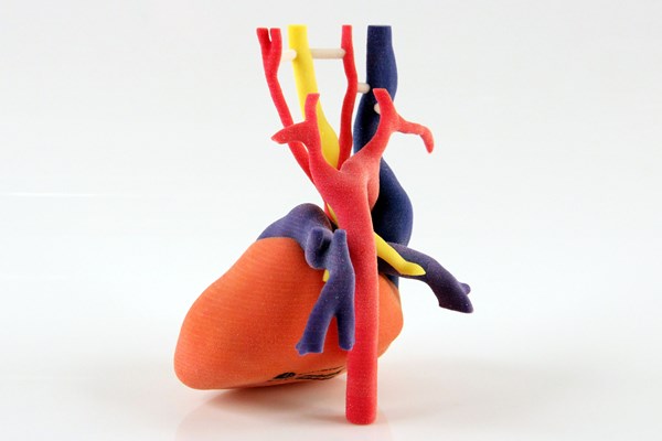 3D Printed Heart Model