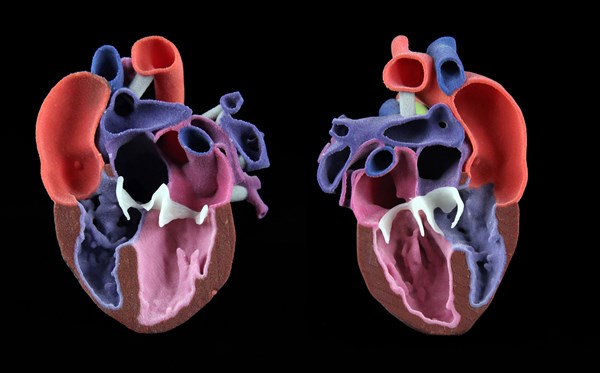3DS CJP Pediatric Heart Model