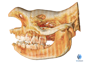 TeraRecon 3D Reconstruction of Rhinocerous CT Images