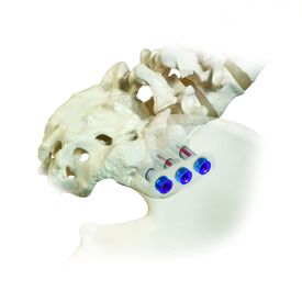 WCHN Sacoiliac illustration